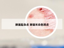 脚面起白点 脚面长白色斑点