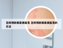 怎样预防银屑病复发 怎样预防银屑病复发的方法