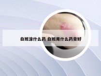 白班涂什么药 白班用什么药膏好