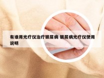 有谁用光疗仪治疗银屑病 银屑病光疗仪使用说明