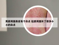 男脐周围表皮有个白点 肚脐周围长了很多小小的白点