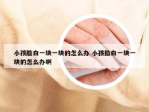 小孩脸白一块一块的怎么办 小孩脸白一块一块的怎么办啊