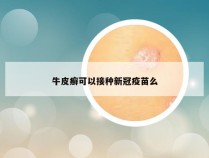 牛皮癣可以接种新冠疫苗么