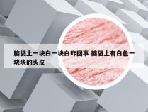 脑袋上一块白一块白咋回事 脑袋上有白色一块块的头皮