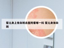 婴儿身上有白班去医院看哪一科 婴儿身体白斑