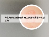 身上为什么突然有癣 身上突然有癣是什么引起的