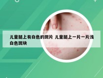 儿童腿上有白色的斑片 儿童腿上一片一片浅白色斑块