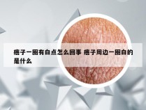 痦子一圈有白点怎么回事 痦子周边一圈白的是什么