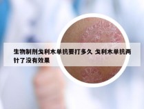 生物制剂戈利木单抗要打多久 戈利木单抗两针了没有效果