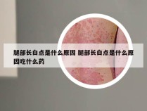 腿部长白点是什么原因 腿部长白点是什么原因吃什么药