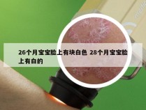 26个月宝宝脸上有块白色 28个月宝宝脸上有白的