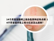 14个月宝宝胳膊上有白色斑块还有点痒 14个月宝宝手臂上有小红点怎么回事?