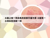 小腿上有一块白色的皮肤不痛不痒 小腿有一小块白色但就一块