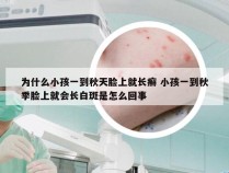 为什么小孩一到秋天脸上就长癣 小孩一到秋季脸上就会长白斑是怎么回事