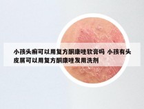 小孩头癣可以用复方酮康唑软膏吗 小孩有头皮屑可以用复方酮康唑发用洗剂