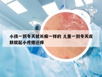 小孩一到冬天就长癣一样的 儿童一到冬天皮肤就起小疙瘩还痒