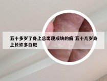 五十多岁了身上总出现成块的癣 五十几岁身上长许多白斑