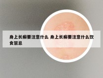 身上长癣要注意什么 身上长癣要注意什么饮食禁忌