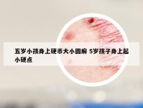 五岁小孩身上硬币大小圆癣 5岁孩子身上起小硬点