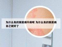 为什么有的银屑病不痒呢 为什么有的银屑病自己就好了