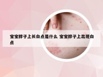 宝宝脖子上长白点是什么 宝宝脖子上出现白点