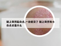 腿上突然起白点,一会就没了 腿上突然有小白点点是什么