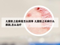 儿童脸上起癣是怎么回事 儿童脸上长癣什么原因,怎么治疗