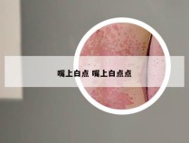 嘴上白点 嘴上白点点