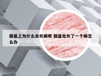 膝盖上为什么会长癣呢 膝盖处长了一个癣怎么办