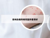 郑州白癜风哪家医院看得好