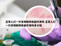 正常人打一针生物制剂有副作用吗 正常人打一针生物制剂有副作用吗多少钱