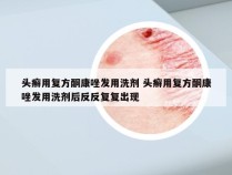 头癣用复方酮康唑发用洗剂 头癣用复方酮康唑发用洗剂后反反复复出现