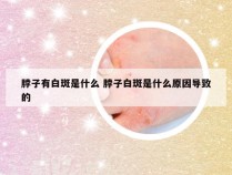 脖子有白斑是什么 脖子白斑是什么原因导致的