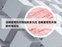 百癣夏塔热片饭后的多久吃 百癣夏塔热片饭前吃饭后吃