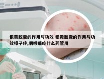 银黄胶囊的作用与功效 银黄胶囊的作用与功效嗓子疼,咽喉痛吃什么药管用