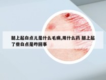 腿上起白点儿是什么毛病,用什么药 腿上起了些白点是咋回事