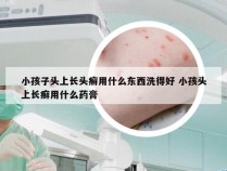 小孩子头上长头癣用什么东西洗得好 小孩头上长癣用什么药膏