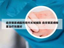 南京银屑病医院现代长城细致 南京银屑病哪里治疗效果好