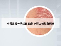 小臂出现一块红色的癣 小臂上长红色斑点