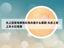 头上后背有癣有红有白是什么原因 头皮上背上长小红疙瘩