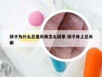 孩子为什么总是长癣怎么回事 孩子身上总长癣