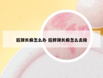 后颈长癣怎么办 后脖颈长癣怎么去除