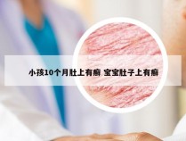 小孩10个月肚上有癣 宝宝肚子上有癣