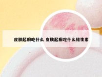 皮肤起癣吃什么 皮肤起癣吃什么维生素