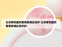 北京哪家医院看银屑病比较好 北京哪家医院看银屑病比较好的