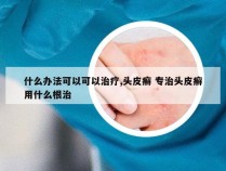 什么办法可以可以治疗,头皮癣 专治头皮癣用什么根治