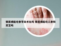 银屑病能吃参苓白术丸吗 银屑病能吃人参和灵芝吗