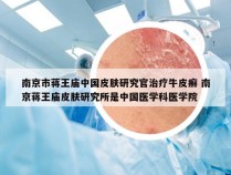 南京市蒋王庙中国皮肤研究官治疗牛皮癣 南京蒋王庙皮肤研究所是中国医学科医学院