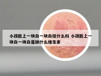 小孩脸上一块白一块白挂什么科 小孩脸上一块白一块白是缺什么维生素