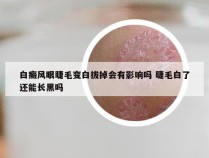 白癜风眼睫毛变白拔掉会有影响吗 睫毛白了还能长黑吗